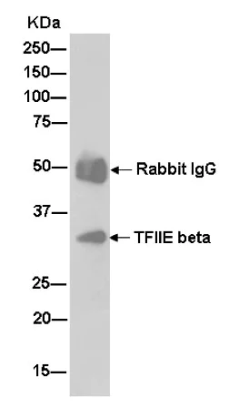Immunoprecipitation - Anti-GTF2E2 antibody [EPR14929] - BSA and Azide free (AB250907)