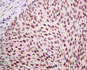Immunohistochemistry (Formalin/PFA-fixed paraffin-embedded sections) - Anti-GTF2F2 antibody [EPR7584] (AB128945)