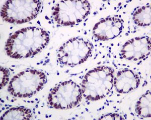 Immunohistochemistry (Formalin/PFA-fixed paraffin-embedded sections) - Anti-GTF2F2 antibody [EPR7584] (AB128945)