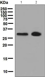 Western blot - Anti-GTF2F2 antibody [EPR7584] (AB128945)
