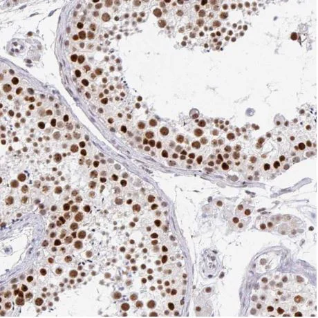 Immunohistochemistry (Formalin/PFA-fixed paraffin-embedded sections) - Anti-GTF2H1 antibody (AB204168)