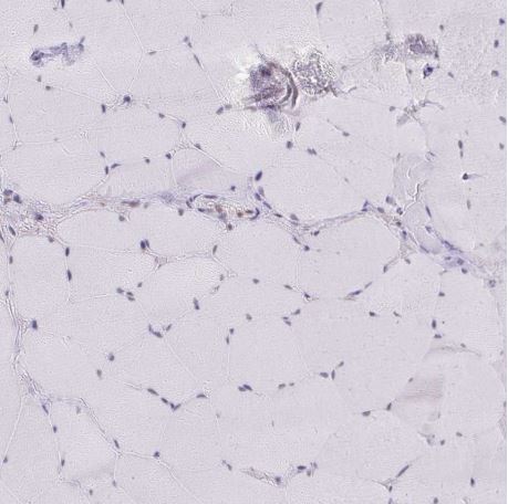 Immunohistochemistry (Formalin/PFA-fixed paraffin-embedded sections) - Anti-GTF2H1 antibody (AB204168)