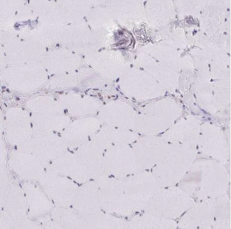 Immunohistochemistry (Formalin/PFA-fixed paraffin-embedded sections) - Anti-GTF2H1 antibody (AB204168)