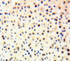 Immunohistochemistry (Formalin/PFA-fixed paraffin-embedded sections) - Anti-GTF2H1 antibody (AB232982)