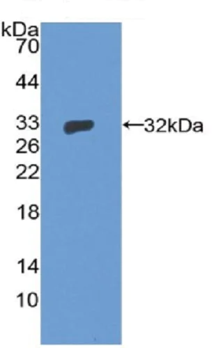 Western blot - Anti-GTF2H1 antibody (AB232982)