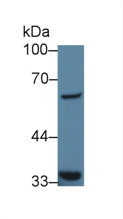 Western blot - Anti-GTF2H1 antibody (AB232982)