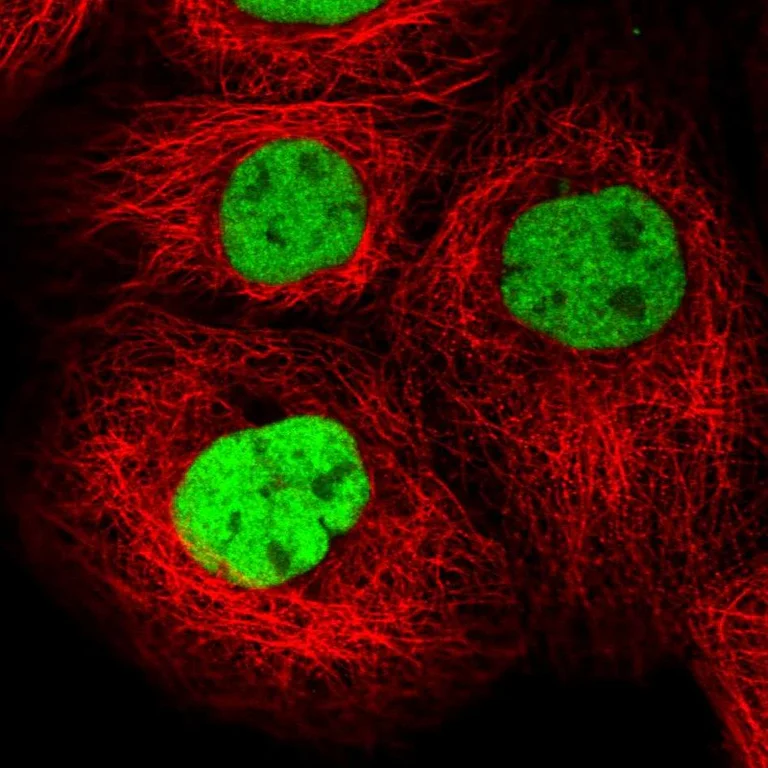 Immunocytochemistry/ Immunofluorescence - Anti-GTF2I Antibody (AB327206)