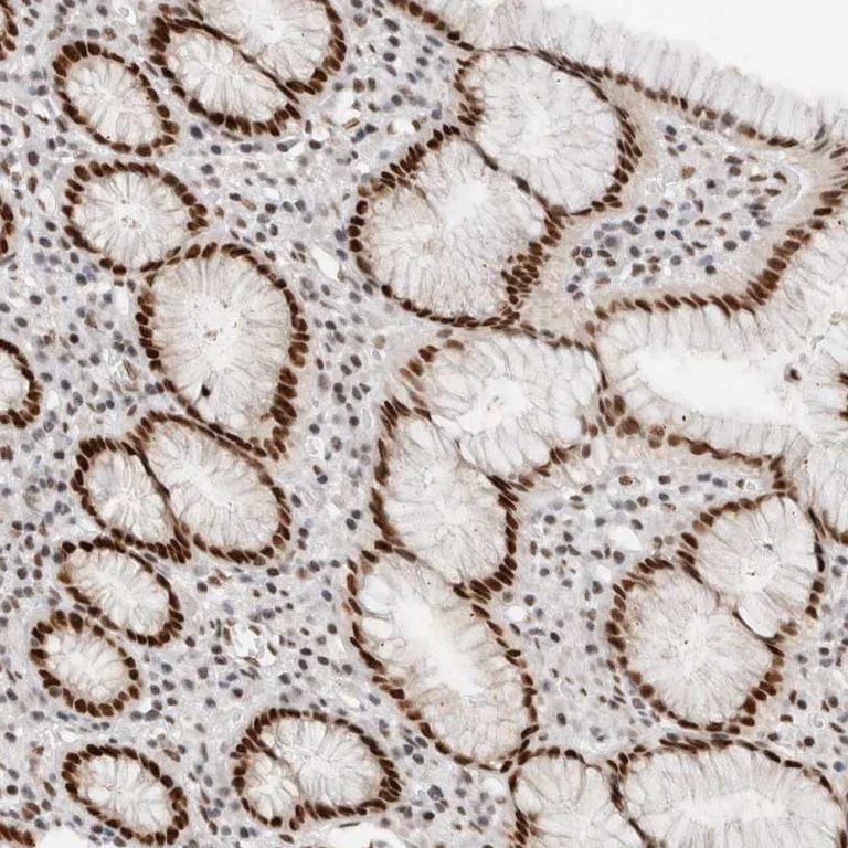 Immunohistochemistry (Formalin/PFA-fixed paraffin-embedded sections) - Anti-GTF2I Antibody (AB327206)
