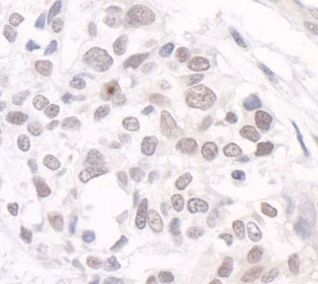Immunohistochemistry (Formalin/PFA-fixed paraffin-embedded sections) - Anti-gtf3c3 antibody (AB74230)
