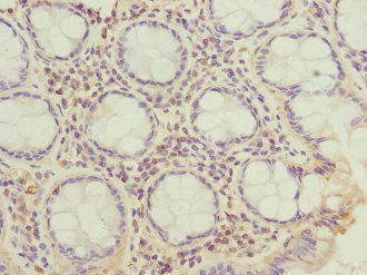 Immunohistochemistry (Formalin/PFA-fixed paraffin-embedded sections) - Anti-GTL3 antibody (AB225952)