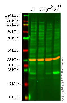 Western blot - Anti-GTPase HRAS antibody [Y132] (AB32417), expandable thumbnail