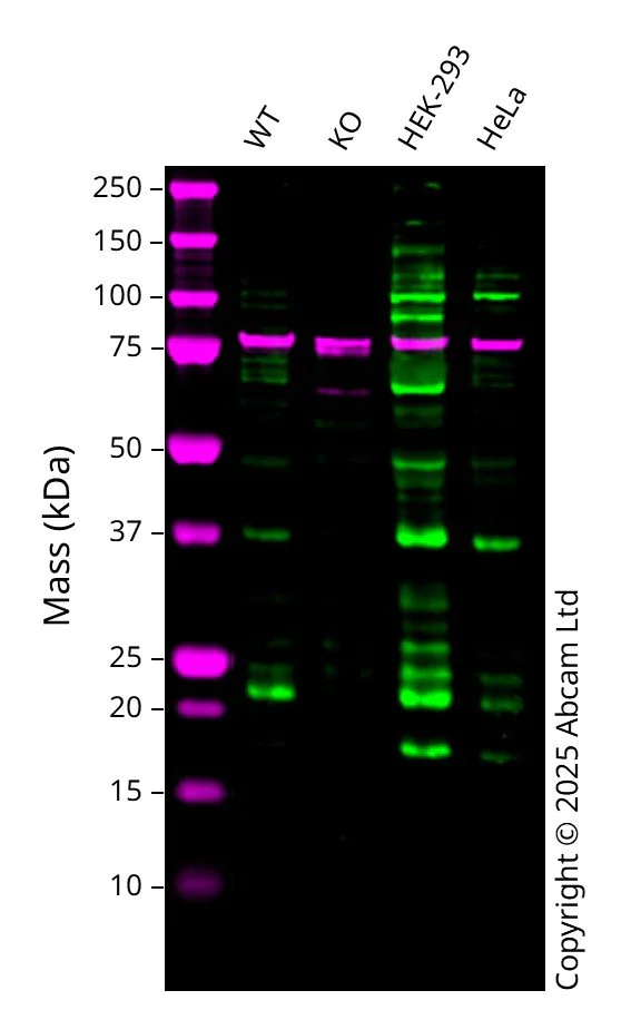 Western blot - Anti-GTPase HRAS antibody [Y132] (AB32417)