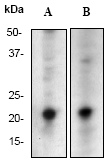 Western blot - Anti-GTPase HRAS antibody [Y132] (AB32417), expandable thumbnail