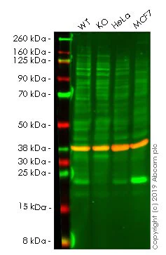 Western blot - Anti-GTPase HRAS antibody [Y132] - BSA and Azide free (AB239815)