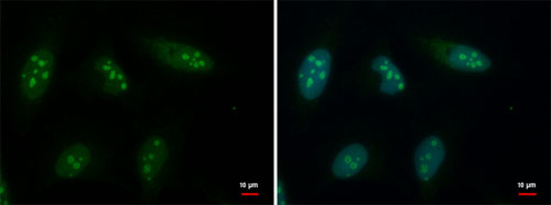 Immunocytochemistry/ Immunofluorescence - Anti-GTPBP4/NOG1 antibody (AB184124), expandable thumbnail