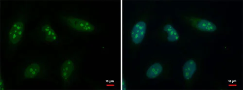 Immunocytochemistry/ Immunofluorescence - Anti-GTPBP4/NOG1 antibody (AB184124)