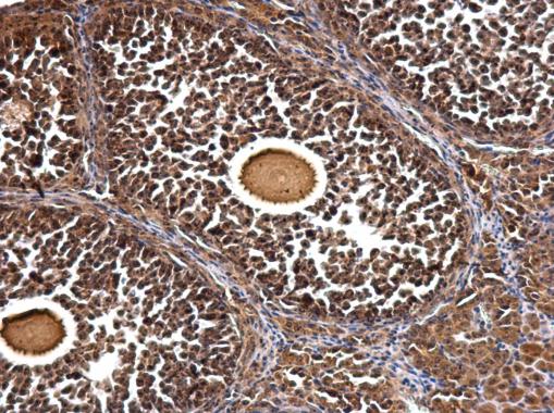 Immunohistochemistry (Formalin/PFA-fixed paraffin-embedded sections) - Anti-GTPBP4/NOG1 antibody (AB184124), expandable thumbnail