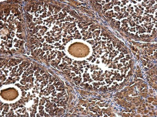 Immunohistochemistry (Formalin/PFA-fixed paraffin-embedded sections) - Anti-GTPBP4/NOG1 antibody (AB184124)