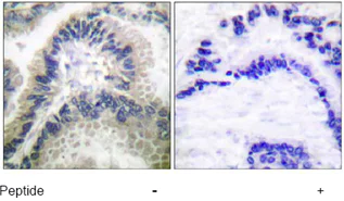 Immunohistochemistry (Formalin/PFA-fixed paraffin-embedded sections) - Anti-Guanylate Cyclase antibody (AB53084)
