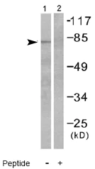 Western blot - Anti-Guanylate Cyclase antibody (AB53084)