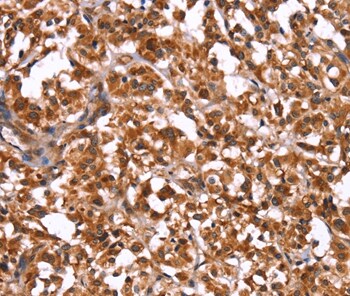 Immunohistochemistry (Formalin/PFA-fixed paraffin-embedded sections) - Anti-Guanylate kinase antibody - C-terminal (AB198816)