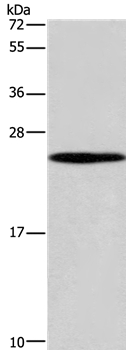 Western blot - Anti-Guanylate kinase antibody - C-terminal (AB198816)