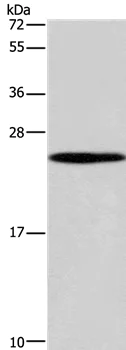 Western blot - Anti-Guanylate kinase antibody - C-terminal (AB198816)