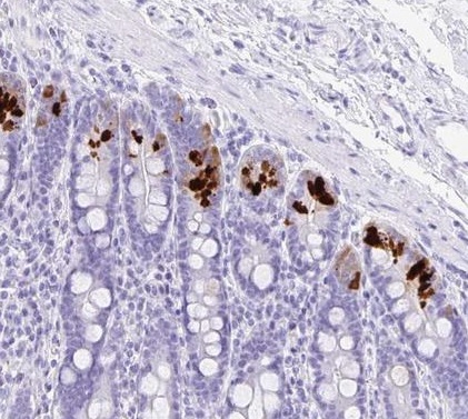Immunohistochemistry (Formalin/PFA-fixed paraffin-embedded sections) - Anti-Guanylin antibody (AB223727), expandable thumbnail