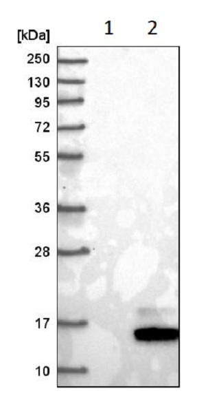 Western blot - Anti-Guanylin antibody (AB223727), expandable thumbnail