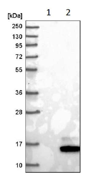 Western blot - Anti-Guanylin antibody (AB223727)
