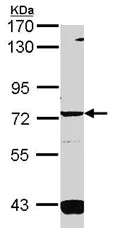 Western blot - Anti-Guanylyl Cyclase alpha 1/GUCY1A3 antibody (AB101368)