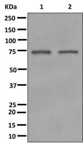Western blot - Anti-Guanylyl Cyclase alpha 1/GUCY1A3 antibody [EPR12270] (AB172480)