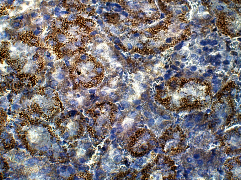 Immunohistochemistry (Formalin/PFA-fixed paraffin-embedded sections) - Anti-GUCY1A2 antibody (AB42108)