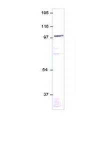 Western blot - Anti-GUCY1A2 antibody (AB42108)