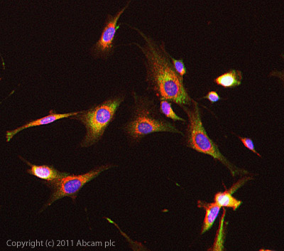 Immunocytochemistry/ Immunofluorescence - Anti-GUCY1B3 antibody (AB24824)