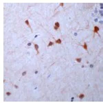 Immunohistochemistry (Formalin/PFA-fixed paraffin-embedded sections) - Anti-GUCY1B3 antibody (AB24824)