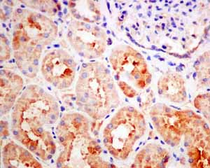 Immunohistochemistry (Formalin/PFA-fixed paraffin-embedded sections) - Anti-GUCY1B3 antibody [EPR8822] (ab154841), expandable thumbnail