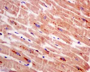Immunohistochemistry (Formalin/PFA-fixed paraffin-embedded sections) - Anti-GUCY1B3 antibody [EPR8822] (ab154841), expandable thumbnail