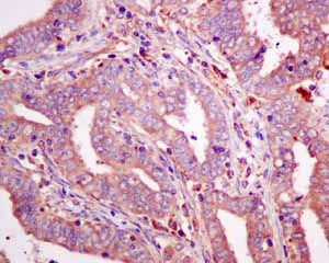 Immunohistochemistry (Formalin/PFA-fixed paraffin-embedded sections) - Anti-GUCY1B3 antibody [EPR8822] (ab154841), expandable thumbnail