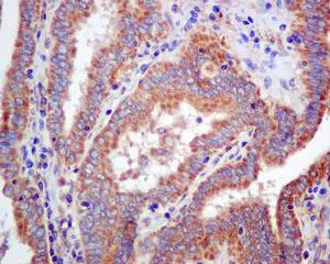 Immunohistochemistry (Formalin/PFA-fixed paraffin-embedded sections) - Anti-GUCY1B3 antibody [EPR8822] (AB154841)