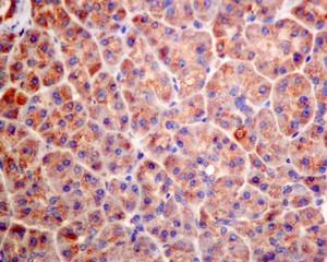 Immunohistochemistry (Formalin/PFA-fixed paraffin-embedded sections) - Anti-GUCY1B3 antibody [EPR8822] (AB154841), expandable thumbnail