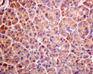 Immunohistochemistry (Formalin/PFA-fixed paraffin-embedded sections) - Anti-GUCY1B3 antibody [EPR8822] (AB154841)