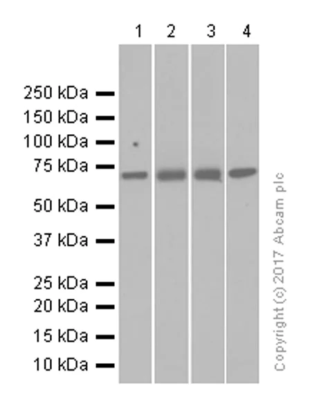 Western blot - Anti-GUCY1B3 antibody [EPR8822] (AB154841)