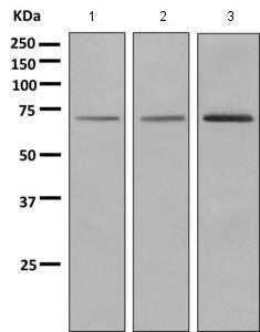 Western blot - Anti-GUCY1B3 antibody [EPR8822] (AB154841), expandable thumbnail