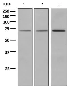 Western blot - Anti-GUCY1B3 antibody [EPR8822] (AB154841)