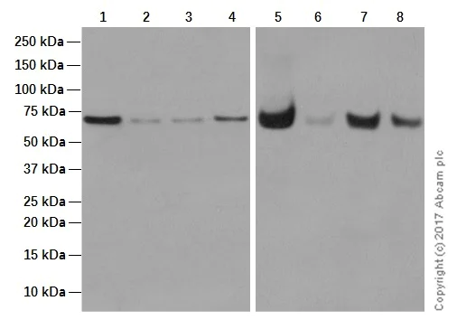Western blot - Anti-GUCY1B3 antibody [EPR8822] (AB154841)
