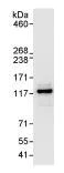 Immunoprecipitation - Anti-GWL antibody (AB86387)