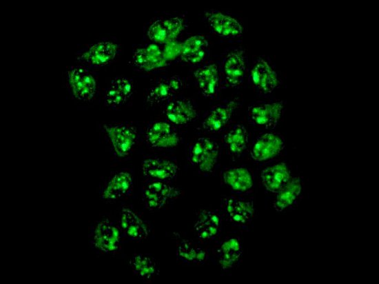 Immunocytochemistry/ Immunofluorescence - Anti-GWL antibody [EPR11719(B)] (AB169767), expandable thumbnail