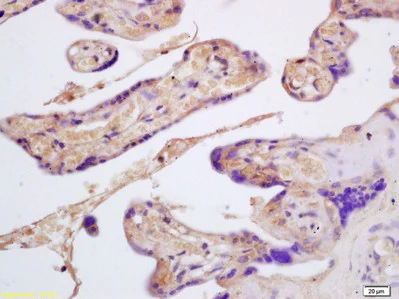 Immunohistochemistry (Formalin/PFA-fixed paraffin-embedded sections) - Anti-GYPB/GPB antibody (AB203341)