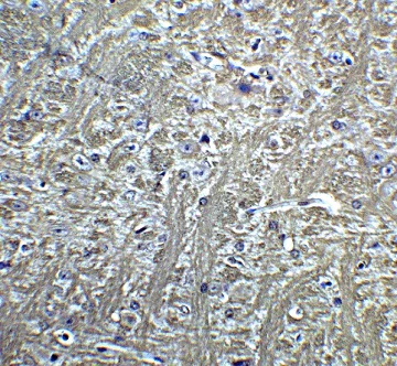 Immunohistochemistry (Formalin/PFA-fixed paraffin-embedded sections) - Anti-H Cadherin antibody (AB36905)